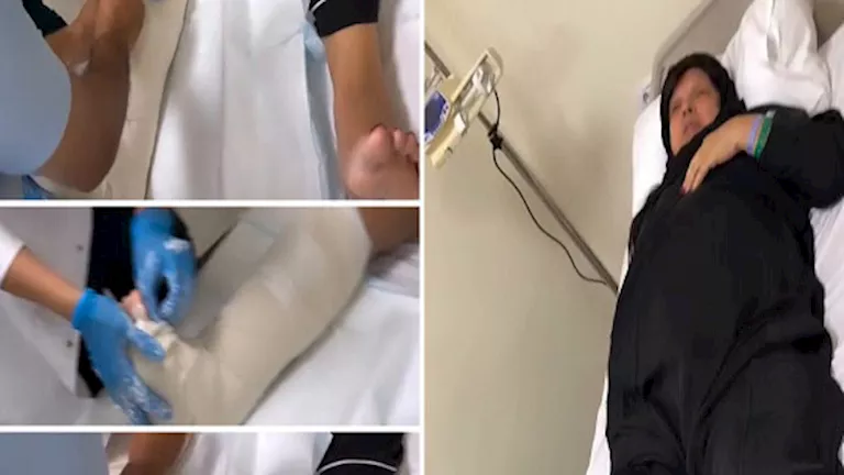 السداد | بعد هروب العجل وانتحار الخروف.. إصابة فيفي عبده بكسر في القدم (فيديو)
