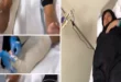 السداد | بعد هروب العجل وسقوط الخروف.. إصابة فيفي عبده بكسر في القدم (فيديو)