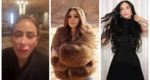 السداد | قبل وبعد.. 10 نجمات تغيرت ملامحهن بسبب التجميل