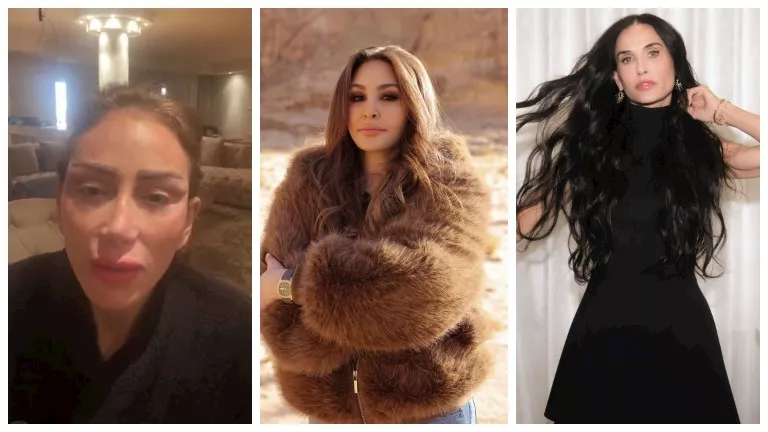 السداد | قبل وبعد.. 10 نجمات تغيرت ملامحهن بسبب التجميل