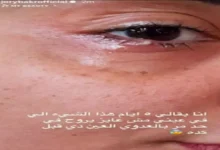 جوري بكر تعلن عن إصابتها بعدوى في عينها وتستمر في المعاناة لليوم الخامس