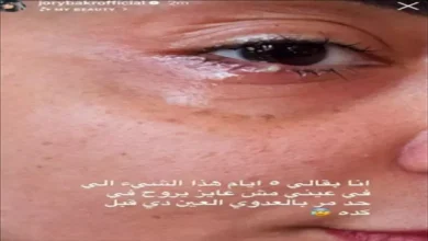 جوري بكر تعلن عن إصابتها بعدوى في عينها وتستمر في المعاناة لليوم الخامس