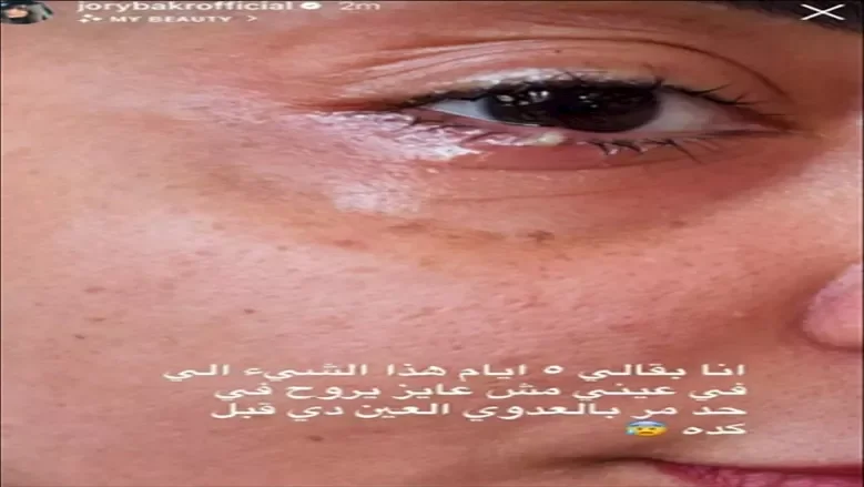 جوري بكر تعلن عن إصابتها بعدوى في عينها وتستمر في المعاناة لليوم الخامس