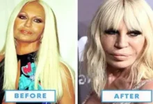 ميجان فوكس تتصدر التريند بعد ظهورها بملامح مختلفة بسبب عمليات التجميل