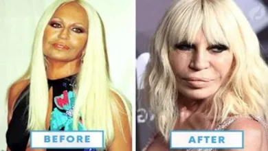 ميجان فوكس تتصدر التريند بعد ظهورها بملامح مختلفة بسبب عمليات التجميل